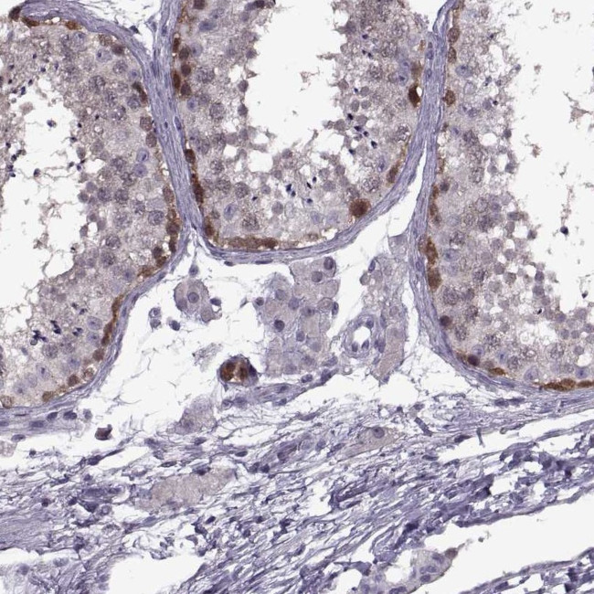 PAGE2B Antibody in Immunohistochemistry (IHC)