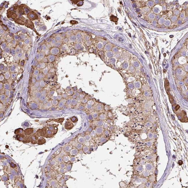 MAGEB5 Antibody in Immunohistochemistry (Paraffin) (IHC (P))