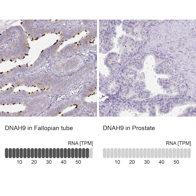 DNAH9 Antibody in Immunohistochemistry (IHC)