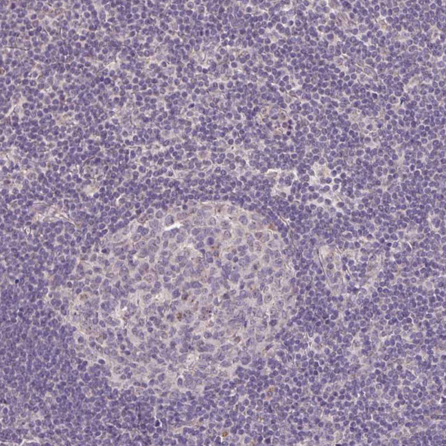 JPH2 Antibody in Immunohistochemistry (Paraffin) (IHC (P))