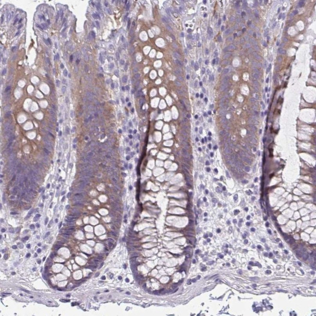 LPIN3 Antibody in Immunohistochemistry (IHC)