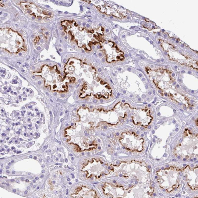 KIAA2013 Antibody in Immunohistochemistry (Paraffin) (IHC (P))