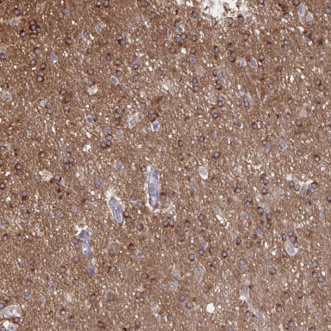 PRRT4 Antibody in Immunohistochemistry (Paraffin) (IHC (P))