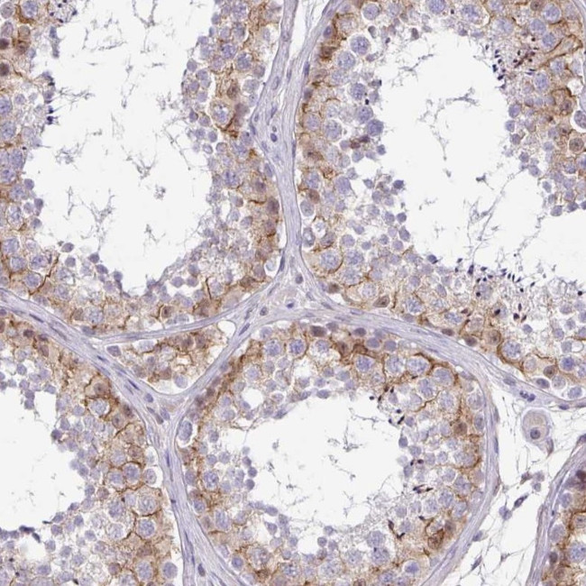 C2orf61 Antibody in Immunohistochemistry (Paraffin) (IHC (P))