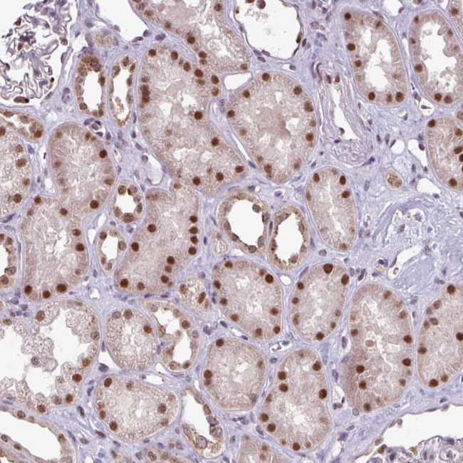 C19orf39 Antibody in Immunohistochemistry (Paraffin) (IHC (P))