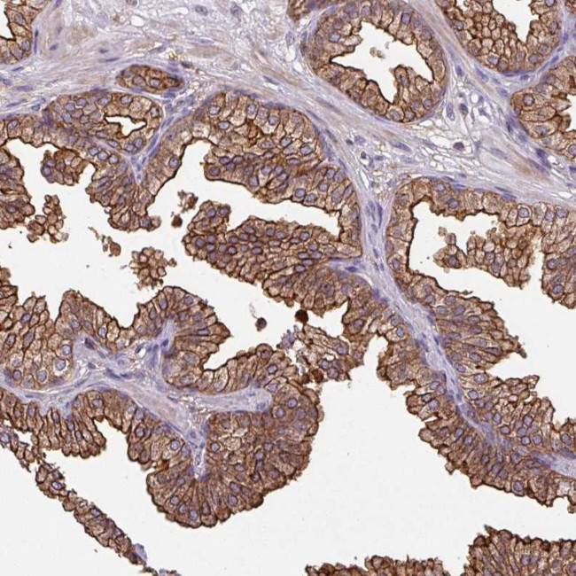 CENPBD1 Antibody in Immunohistochemistry (Paraffin) (IHC (P))