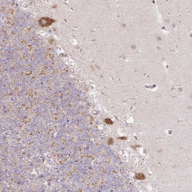 MLX Antibody in Immunohistochemistry (Paraffin) (IHC (P))