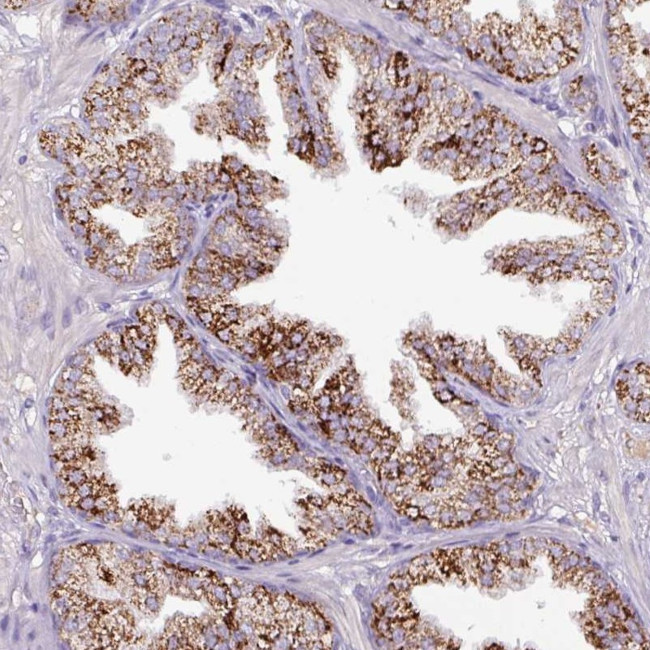 V-ATPase E2 Antibody in Immunohistochemistry (Paraffin) (IHC (P))