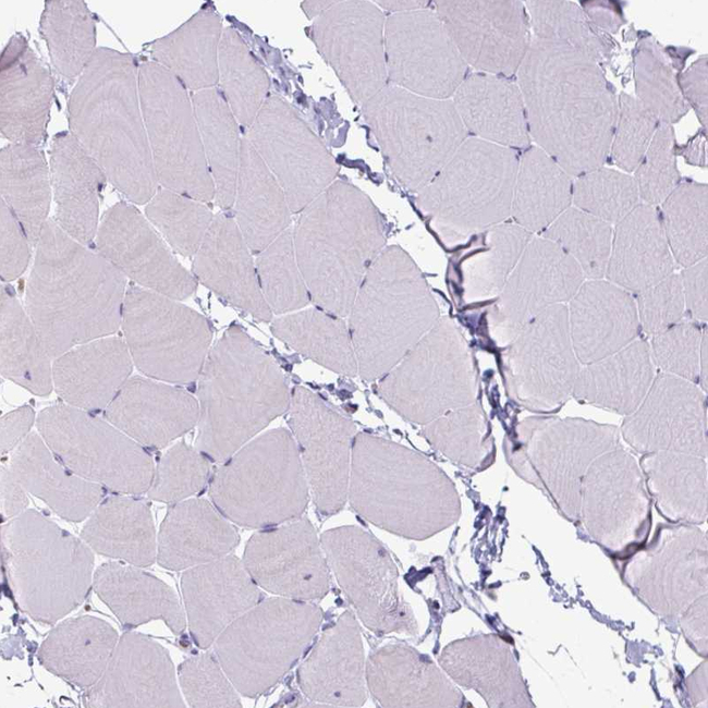 CLCA1 Antibody in Immunohistochemistry (Paraffin) (IHC (P))