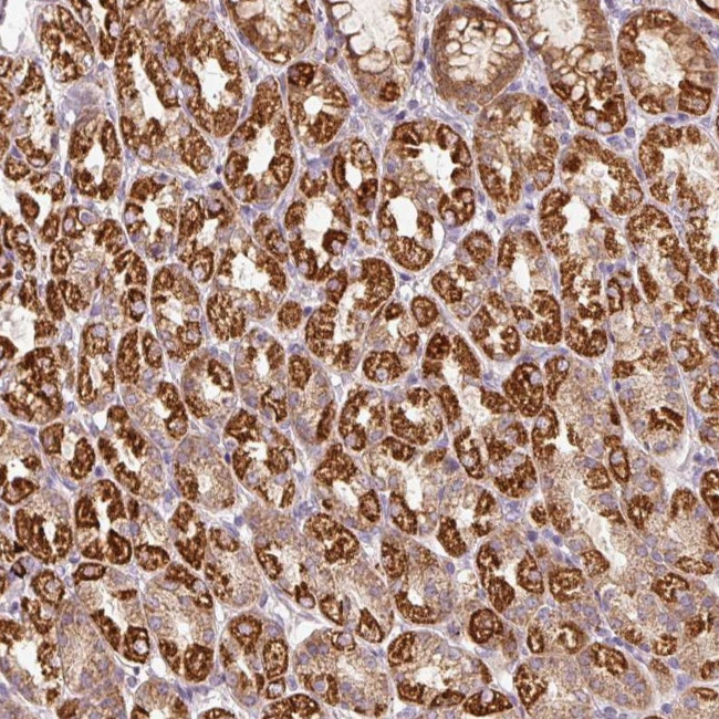 FAM78B Antibody in Immunohistochemistry (Paraffin) (IHC (P))