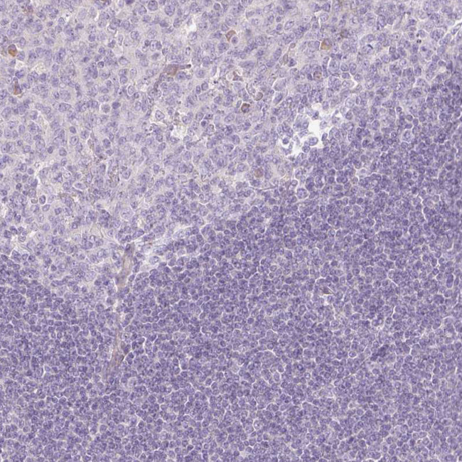 PAQR9 Antibody in Immunohistochemistry (IHC)