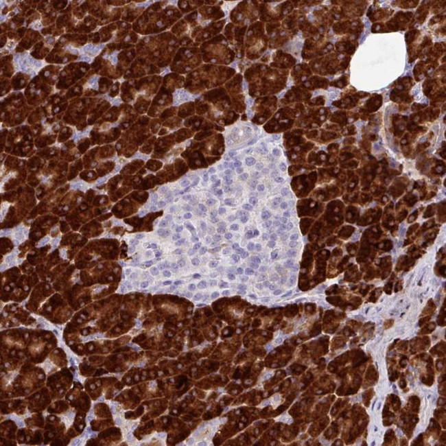 RGS21 Antibody in Immunohistochemistry (Paraffin) (IHC (P))
