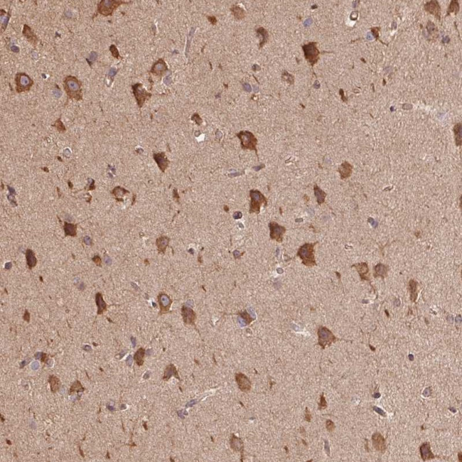 C6orf163 Antibody in Immunohistochemistry (Paraffin) (IHC (P))