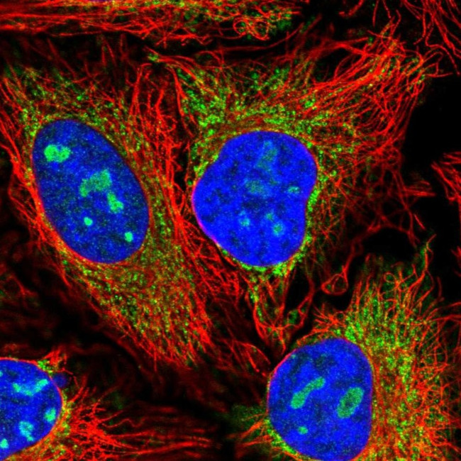 NACC2 Antibody in Immunocytochemistry (ICC/IF)