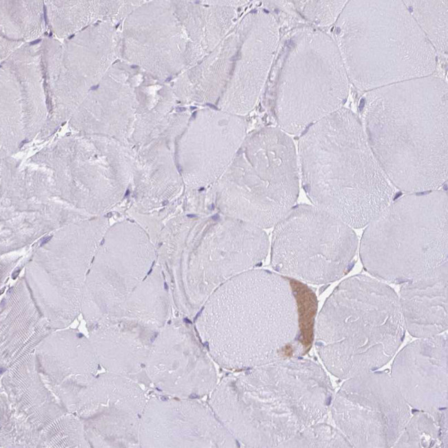 COL17A1 Antibody in Immunohistochemistry (Paraffin) (IHC (P))