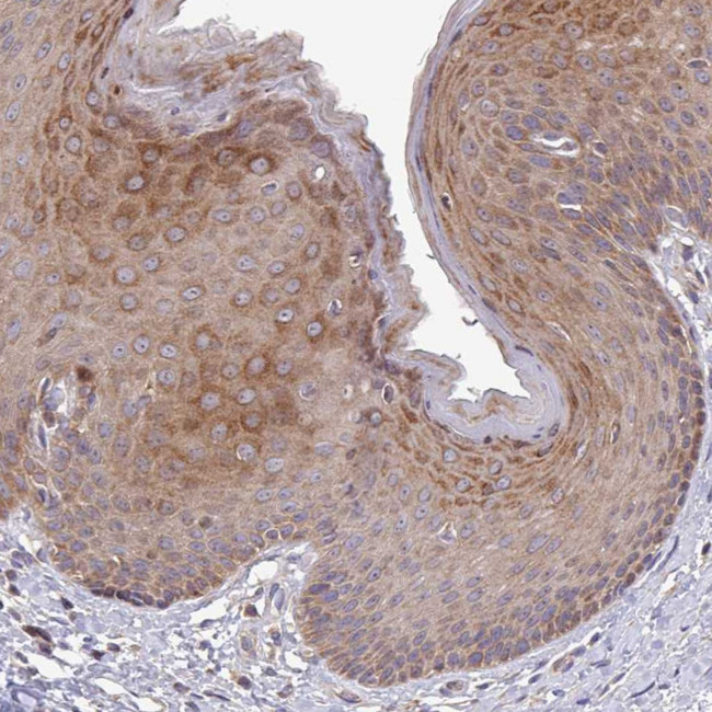 TWEAK Antibody in Immunohistochemistry (Paraffin) (IHC (P))