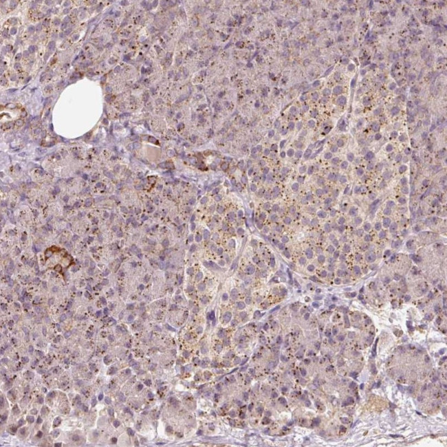 ZNF460 Antibody in Immunohistochemistry (Paraffin) (IHC (P))