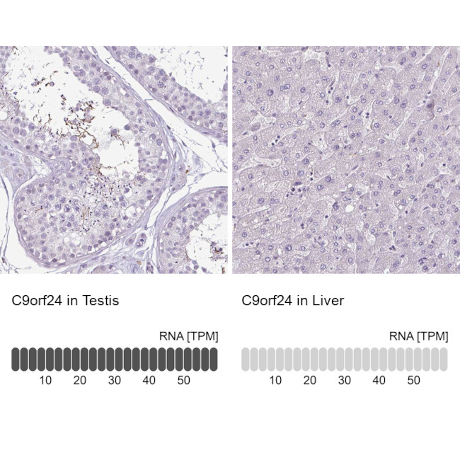 C9orf24 Antibody in Immunohistochemistry (IHC)