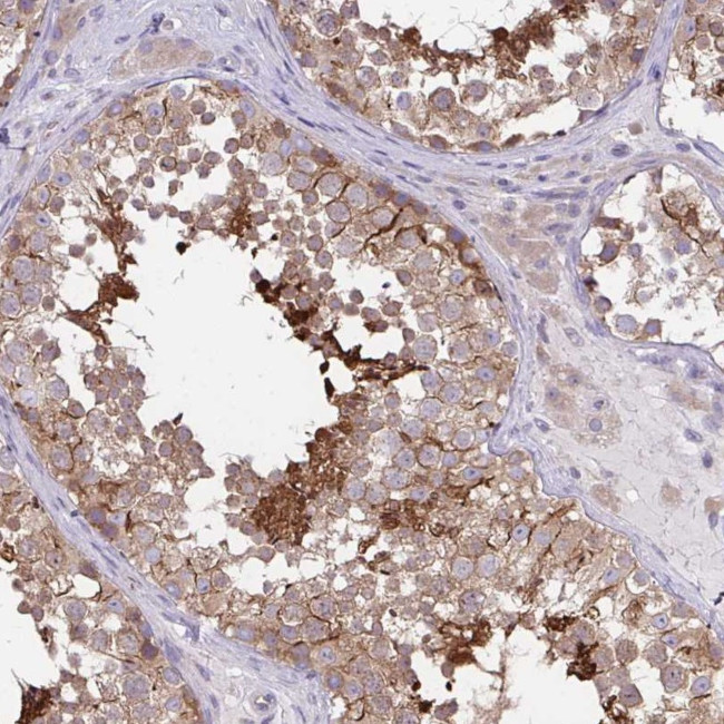 CFAP97D1 Antibody in Immunohistochemistry (Paraffin) (IHC (P))