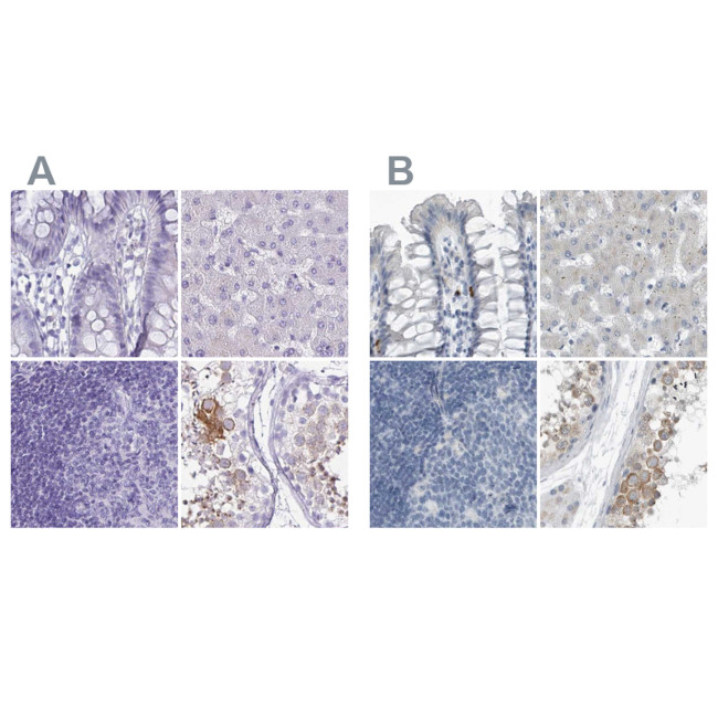 ZPBP2 Antibody in Immunohistochemistry (IHC)