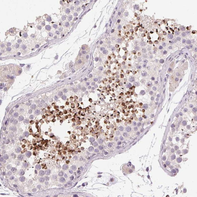 LYZL6 Antibody in Immunohistochemistry (Paraffin) (IHC (P))