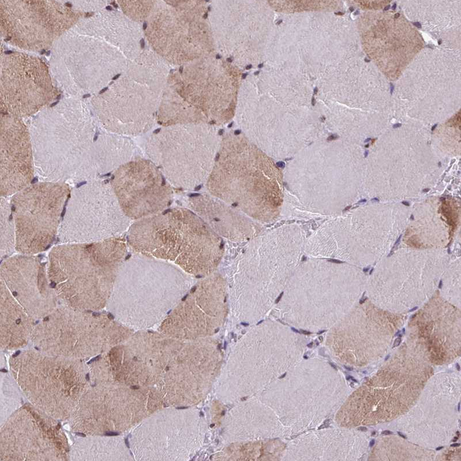 ZFP3 Antibody in Immunohistochemistry (Paraffin) (IHC (P))