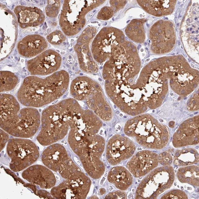 OTOP2 Antibody in Immunohistochemistry (Paraffin) (IHC (P))