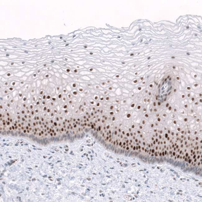 TRIP13 Antibody in Immunohistochemistry (Paraffin) (IHC (P))