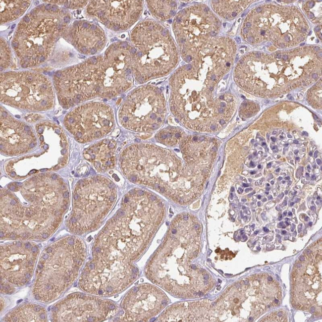 TSEN54 Antibody in Immunohistochemistry (Paraffin) (IHC (P))