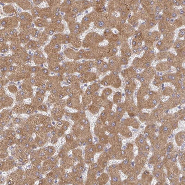 RHEBL1 Antibody in Immunohistochemistry (IHC)