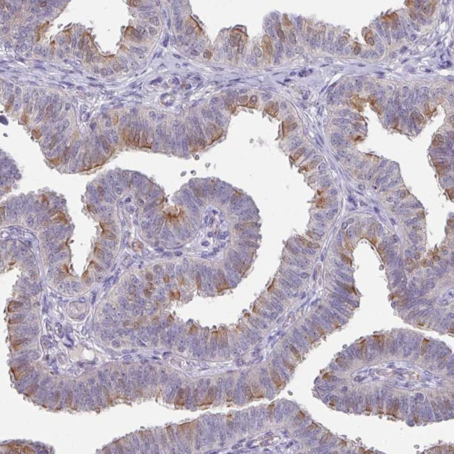DCAF12L2 Antibody in Immunohistochemistry (Paraffin) (IHC (P))