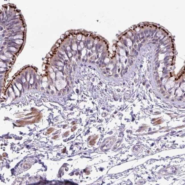SPINK8 Antibody in Immunohistochemistry (Paraffin) (IHC (P))