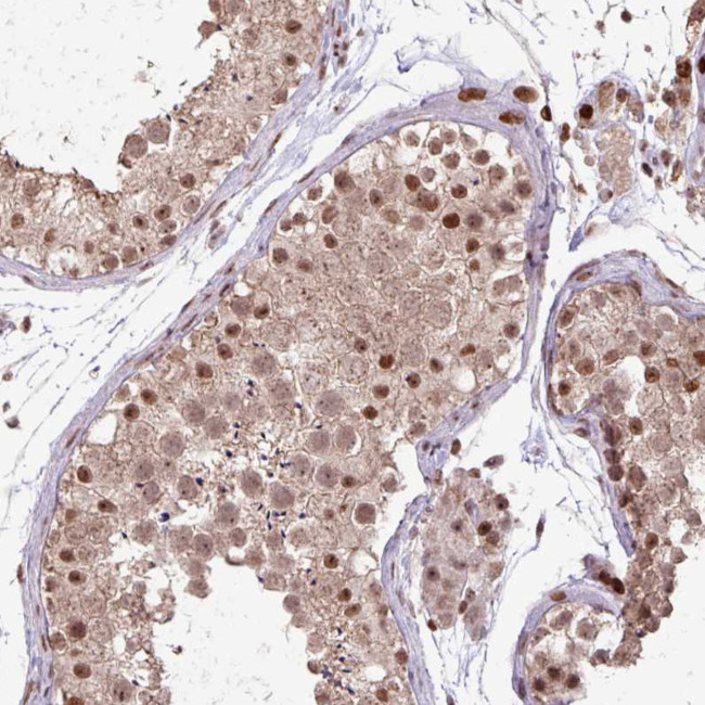 ZNF709 Antibody in Immunohistochemistry (Paraffin) (IHC (P))