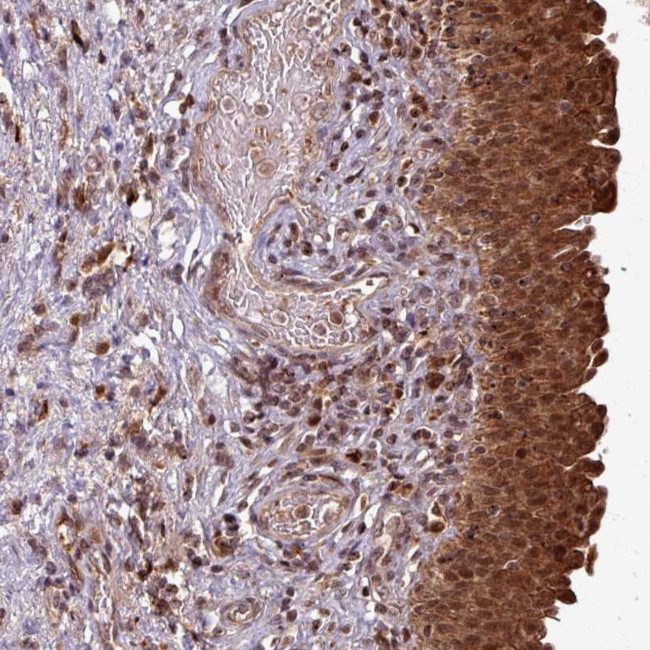 OR6B1 Antibody in Immunohistochemistry (Paraffin) (IHC (P))
