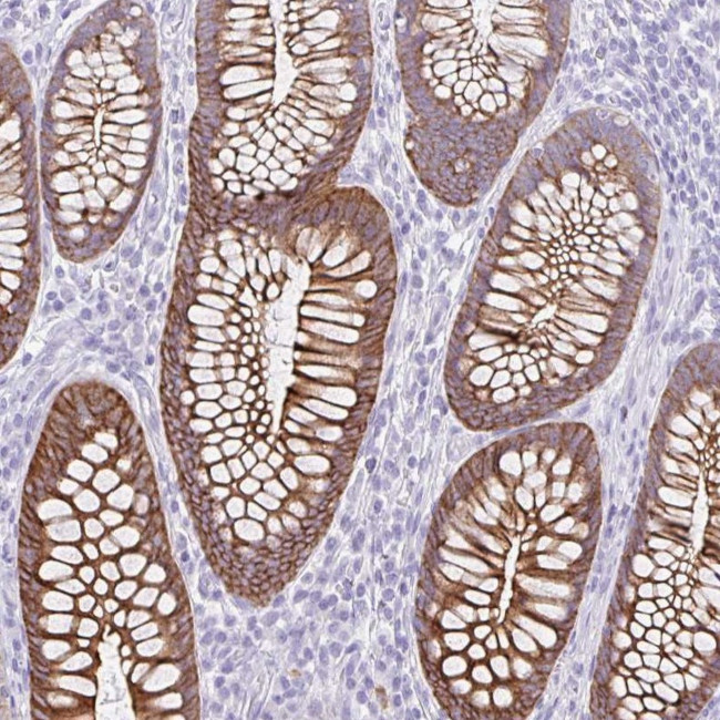 DTWD2 Antibody in Immunohistochemistry (Paraffin) (IHC (P))