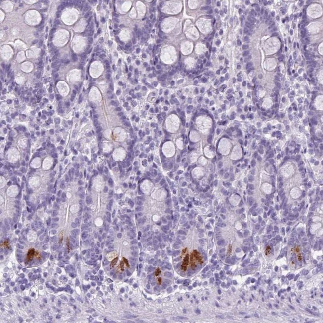 TMEM91 Antibody in Immunohistochemistry (IHC)