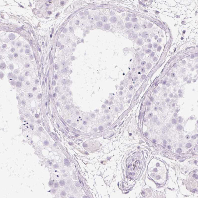 PR38B Antibody in Immunohistochemistry (Paraffin) (IHC (P))