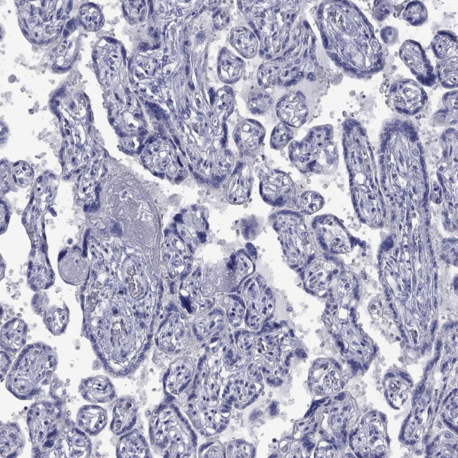 ABCB4 Antibody in Immunohistochemistry (Paraffin) (IHC (P))