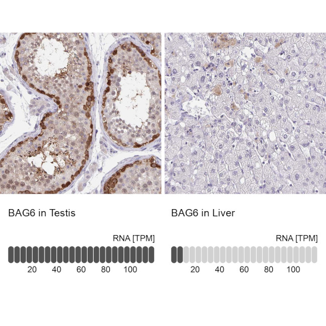 BAG6 Antibody in Immunohistochemistry (IHC)