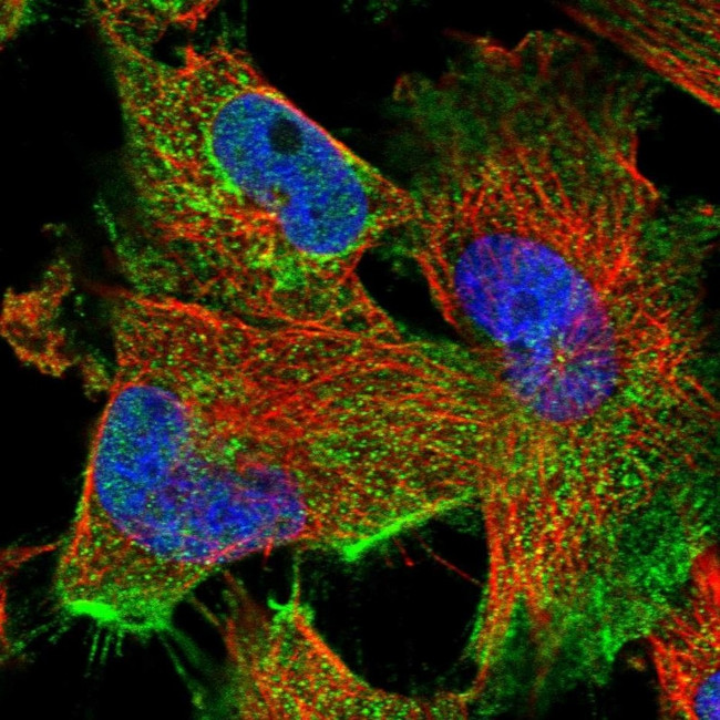FAM47E Antibody in Immunocytochemistry (ICC/IF)