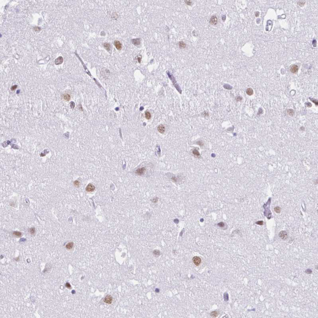DCAF17 Antibody in Immunohistochemistry (Paraffin) (IHC (P))