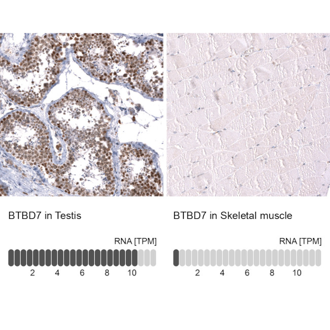 BTBD7 Antibody in Immunohistochemistry (Paraffin) (IHC (P))