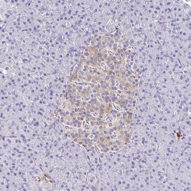 PPFIA4 Antibody in Immunohistochemistry (Paraffin) (IHC (P))