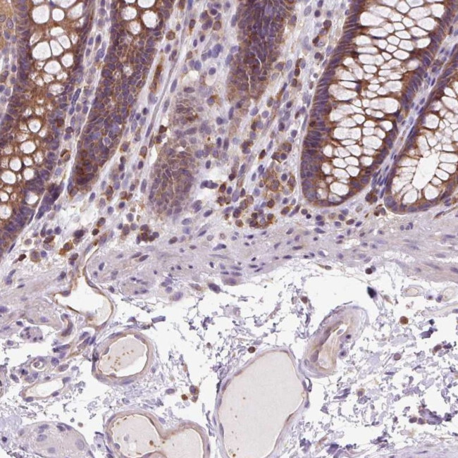 CISD3 Antibody in Immunohistochemistry (Paraffin) (IHC (P))