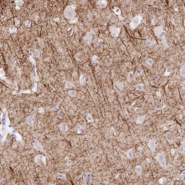 EMC4 Antibody in Immunohistochemistry (IHC)