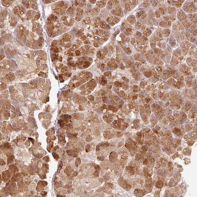 RGL2 Antibody in Immunohistochemistry (Paraffin) (IHC (P))