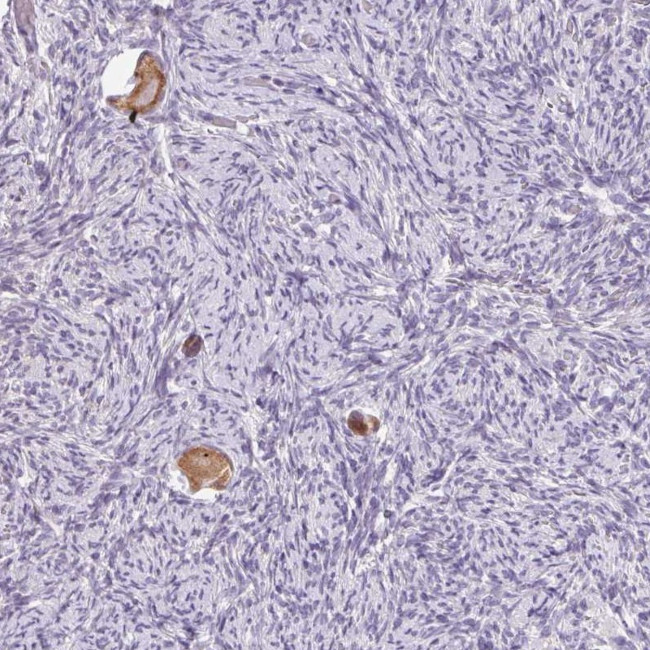 SNX31 Antibody in Immunohistochemistry (Paraffin) (IHC (P))