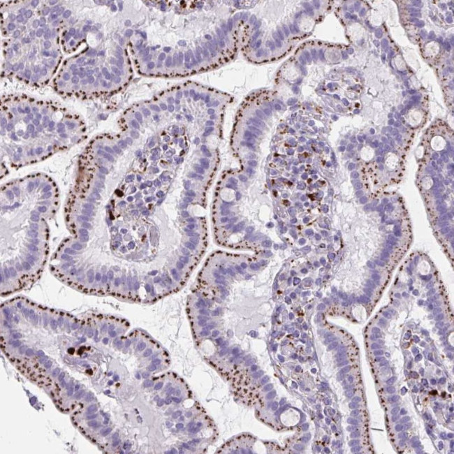 Cathepsin Z Antibody in Immunohistochemistry (Paraffin) (IHC (P))