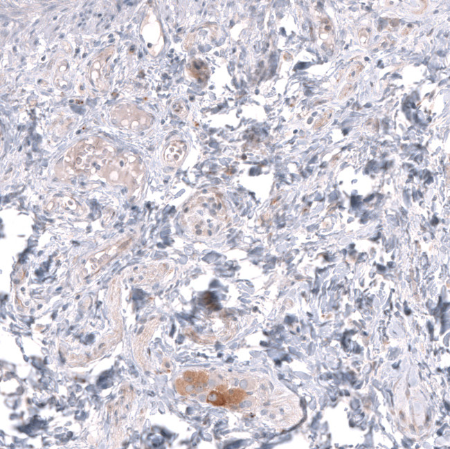 TTYH3 Antibody in Immunohistochemistry (Paraffin) (IHC (P))