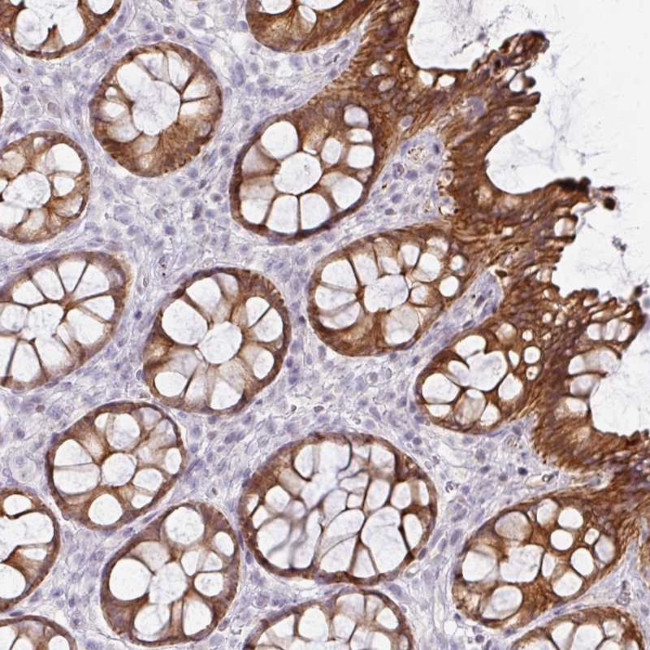 GTF2H3 Antibody in Immunohistochemistry (Paraffin) (IHC (P))